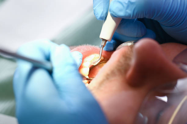 Best Emergency Gum Treatment in Fiskdale, MA